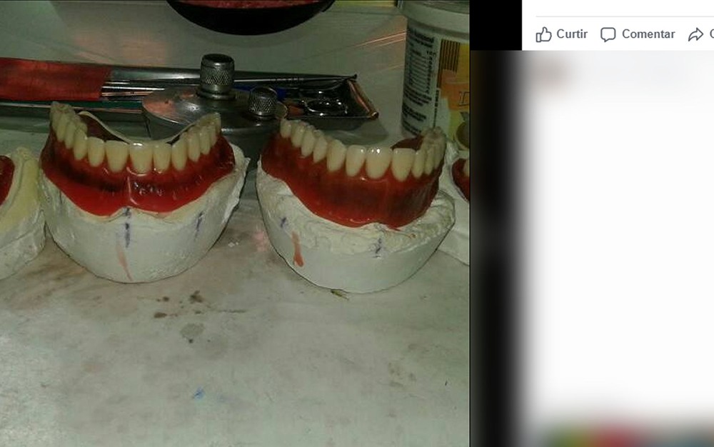 Homem que atuava ilegalmente há 32 anos com venda de próteses dentárias é detido