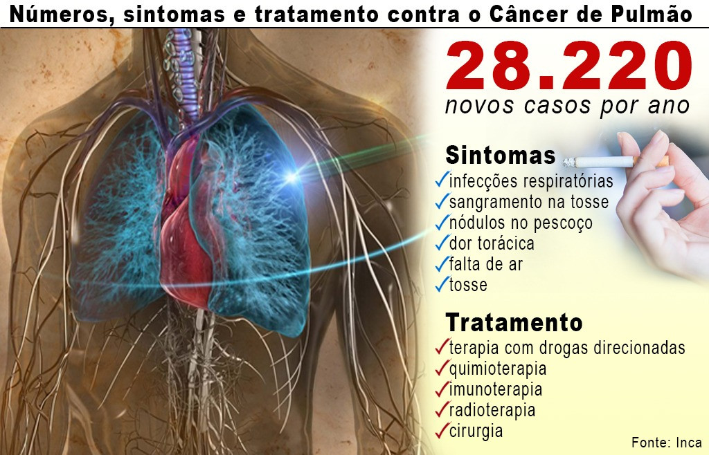 Oncologista alerta que fumantes têm 20 x mais chances de ter câncer de pulmão